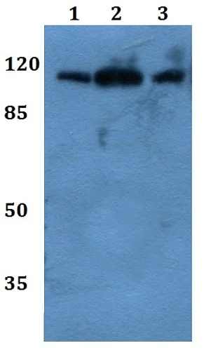 Western blot - Anti-Mkl2 antibody (AB191496)