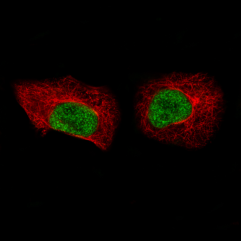 Immunocytochemistry/ Immunofluorescence - Anti-Mkl2 antibody [CL1546] (AB242312), expandable thumbnail