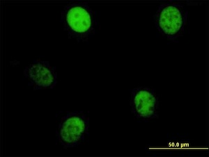Immunocytochemistry/ Immunofluorescence - Anti-MKLP1 antibody (AB168964)