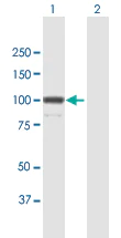 Western blot - Anti-MKLP1 antibody (AB168964)