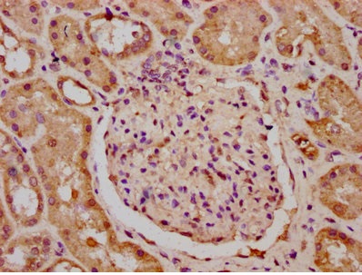 Immunohistochemistry (Formalin/PFA-fixed paraffin-embedded sections) - Anti-MKLP1 antibody (AB235955)