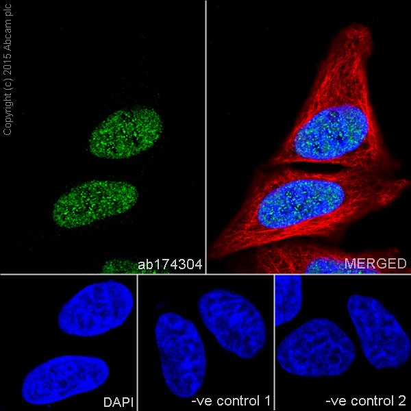 Anti-MKLP1 antibody [EPR10879] Rabbit monoclonal (ab174304