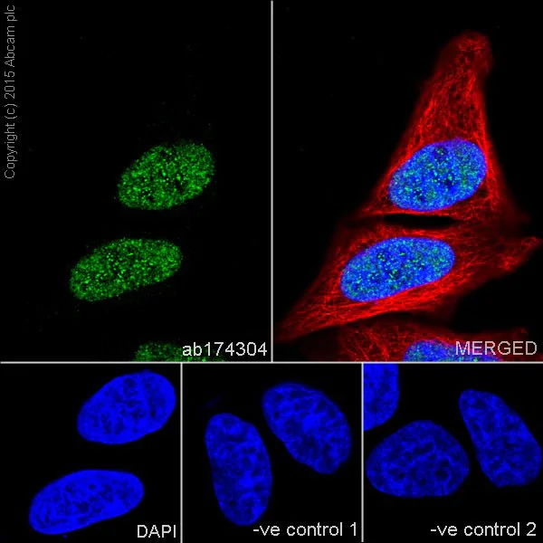 Immunocytochemistry/ Immunofluorescence - Anti-MKLP1 antibody [EPR10879] - BSA and Azide free (AB240178)