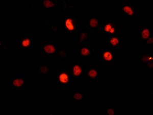 Immunocytochemistry/ Immunofluorescence - Anti-MKLP1 antibody [EPR10879] - BSA and Azide free (AB240178)