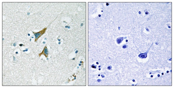 Immunohistochemistry paraffin embedded sections - Anti-MKP-1 antibody (AB61201)