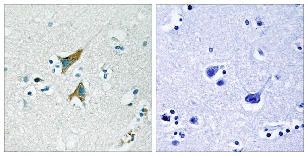 Immunohistochemistry paraffin embedded sections - Anti-MKP-1 antibody (AB61201)