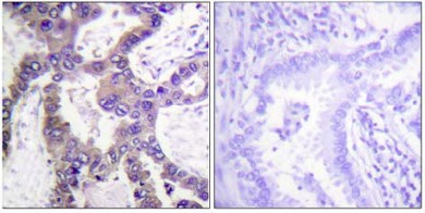 Immunohistochemistry (Formalin/PFA-fixed paraffin-embedded sections) - Anti-MKP-1 (phospho S359) antibody (AB63548)