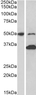 Western blot - Anti-MKRN1 antibody (AB123804)