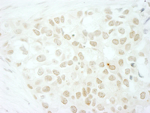 Immunohistochemistry (Formalin/PFA-fixed paraffin-embedded sections) - Anti-MKRN2 antibody (AB72055)