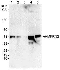Western blot - Anti-MKRN2 antibody (AB72055)