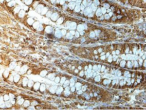 Immunohistochemistry (Formalin/PFA-fixed paraffin-embedded sections) - Anti-MKRN3 antibody (AB177203)