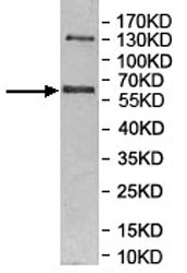 Western blot - Anti-MKRN3 antibody (AB177203)