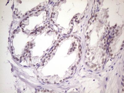 Immunohistochemistry (Formalin/PFA-fixed paraffin-embedded sections) - Anti-MKX antibody [OTI6A12] (AB236400)