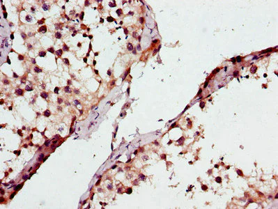 Immunohistochemistry (Formalin/PFA-fixed paraffin-embedded sections) - Anti-ML-1 antibody (AB223066)