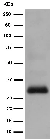 Western blot - Anti-MLC1 antibody [EPR10942(2)] - BSA and Azide free (AB250888)
