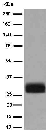 Western blot - Anti-MLC1 antibody [EPR10942(2)] - N-terminal (AB186436)
