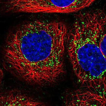 Immunocytochemistry/ Immunofluorescence - Anti-MLC1SA antibody (AB243737)