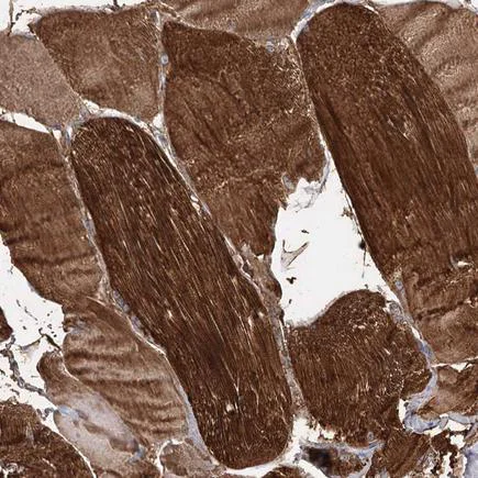 Immunohistochemistry (Formalin/PFA-fixed paraffin-embedded sections) - Anti-MLC1SA antibody (AB243737)