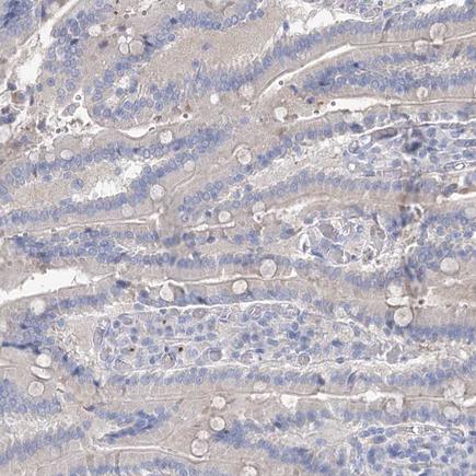 Immunohistochemistry (Formalin/PFA-fixed paraffin-embedded sections) - Anti-MLC1SA antibody (AB243737)