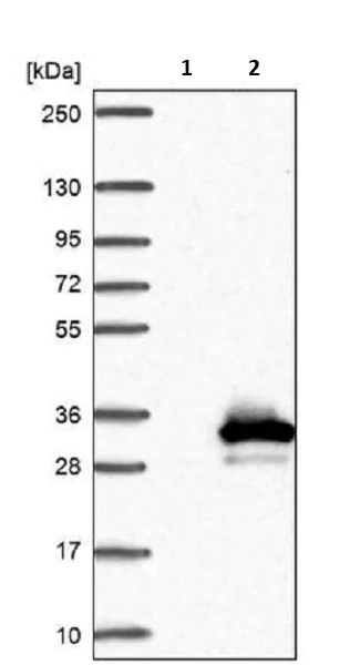 Western blot - Anti-MLC1SA antibody (AB243737)
