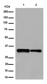 Western blot - Anti-MLD antibody [EPR9680] (AB185237)