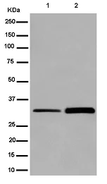 Western blot - Anti-MLD antibody [EPR9680] (AB185237)