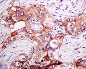 Immunohistochemistry (Formalin/PFA-fixed paraffin-embedded sections) - Anti-MLD antibody [EPR9681] (AB167169)