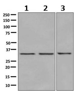 Western blot - Anti-MLD antibody [EPR9681] (AB167169), expandable thumbnail