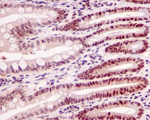 Immunohistochemistry (Formalin/PFA-fixed paraffin-embedded sections) - Anti-MLF2 antibody [EPR10245(2)] - BSA and Azide free (AB250186)