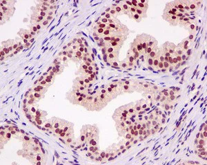 Immunohistochemistry (Formalin/PFA-fixed paraffin-embedded sections) - Anti-MLF2 antibody [EPR10245(2)] - BSA and Azide free (AB250186)