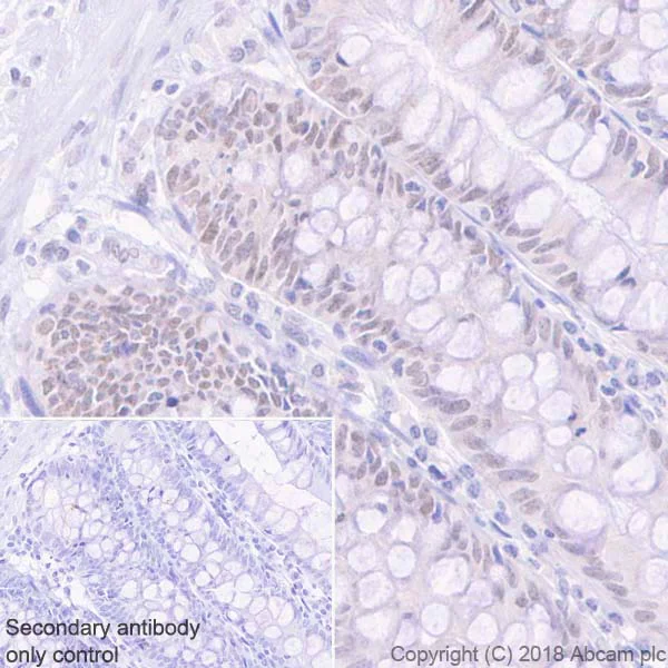 Immunohistochemistry (Formalin/PFA-fixed paraffin-embedded sections) - Anti-MLH1 antibody [EPR20522] (AB223844)