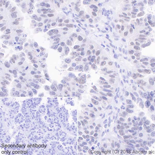 Immunohistochemistry (Formalin/PFA-fixed paraffin-embedded sections) - Anti-MLH1 antibody [EPR20522] - BSA and Azide free (ab251576), expandable thumbnail