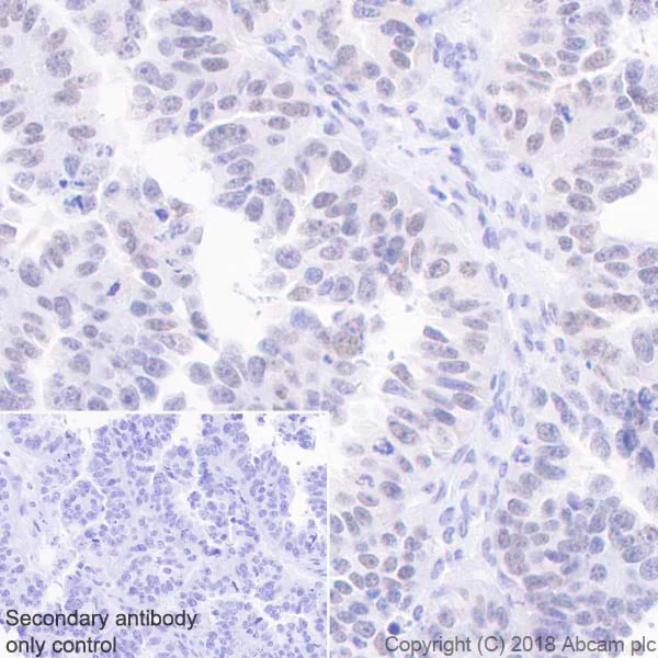 Immunohistochemistry (Formalin/PFA-fixed paraffin-embedded sections) - Anti-MLH1 antibody [EPR20522] - BSA and Azide free (AB251576)