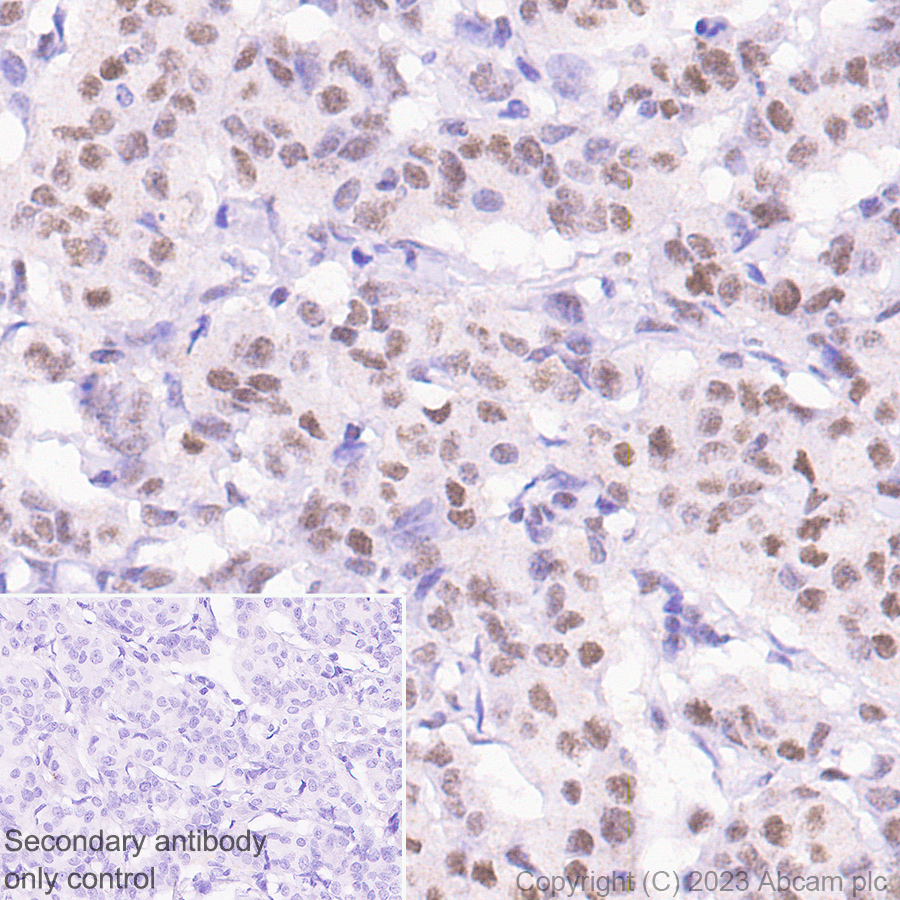 Immunohistochemistry (Formalin/PFA-fixed paraffin-embedded sections) - Anti-MLH1 antibody [EPR20522] - BSA and Azide free (ab251576), expandable thumbnail