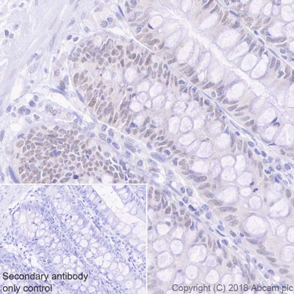 Immunohistochemistry (Formalin/PFA-fixed paraffin-embedded sections) - Anti-MLH1 antibody [EPR20522] - BSA and Azide free (AB251576), expandable thumbnail