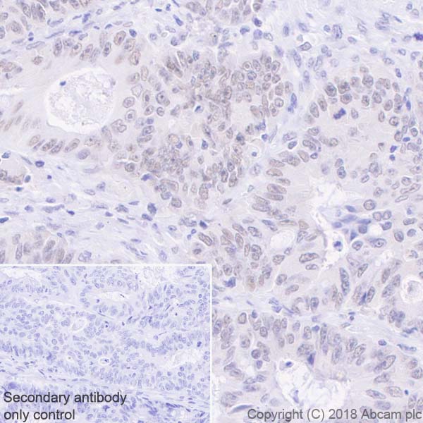 Immunohistochemistry (Formalin/PFA-fixed paraffin-embedded sections) - Anti-MLH1 antibody [EPR20522] - BSA and Azide free (AB251576), expandable thumbnail