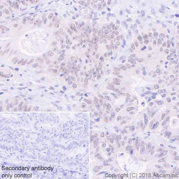 Immunohistochemistry (Formalin/PFA-fixed paraffin-embedded sections) - Anti-MLH1 antibody [EPR20522] - BSA and Azide free (AB251576)