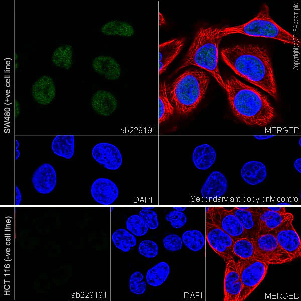 Immunocytochemistry/ Immunofluorescence - Anti-MLH1 antibody [EPR20741] (AB229191)