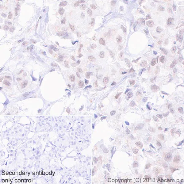 Immunohistochemistry (Formalin/PFA-fixed paraffin-embedded sections) - Anti-MLH1 antibody [EPR20741] (AB229191)