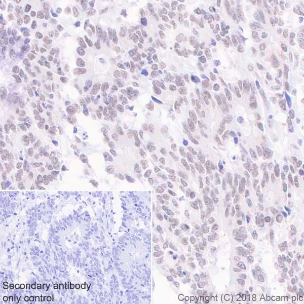 Immunohistochemistry (Formalin/PFA-fixed paraffin-embedded sections) - Anti-MLH1 antibody [EPR20741] (AB229191)