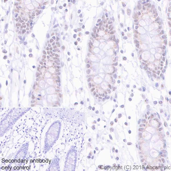 Immunohistochemistry (Formalin/PFA-fixed paraffin-embedded sections) - Anti-MLH1 antibody [EPR20741] (AB229191)