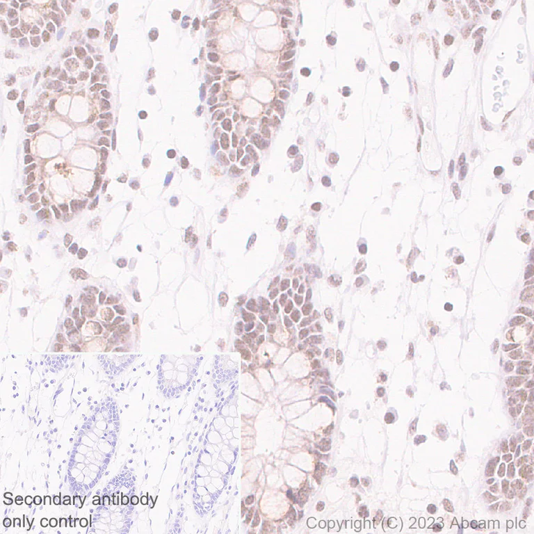 Immunohistochemistry (Formalin/PFA-fixed paraffin-embedded sections) - Anti-MLH1 antibody [EPR26314-1] - BSA and Azide free (AB315012)
