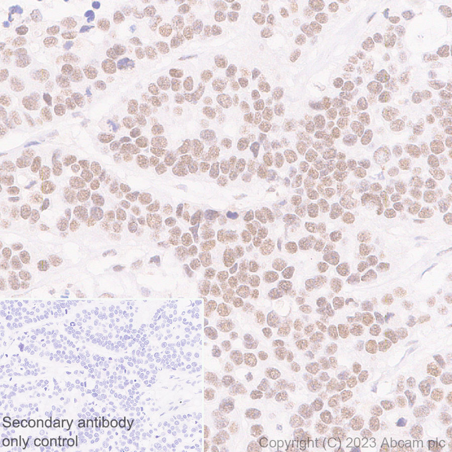 Immunohistochemistry (Formalin/PFA-fixed paraffin-embedded sections) - Anti-MLH1 antibody [EPR26314-1] - BSA and Azide free (ab315012), expandable thumbnail