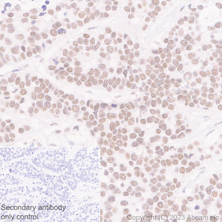 Immunohistochemistry (Formalin/PFA-fixed paraffin-embedded sections) - Anti-MLH1 antibody [EPR26314-1] - BSA and Azide free (AB315012)