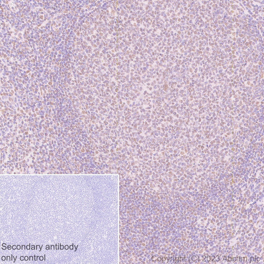 Immunohistochemistry (Formalin/PFA-fixed paraffin-embedded sections) - Anti-MLH1 antibody [EPR26314-1] - BSA and Azide free (ab315012), expandable thumbnail