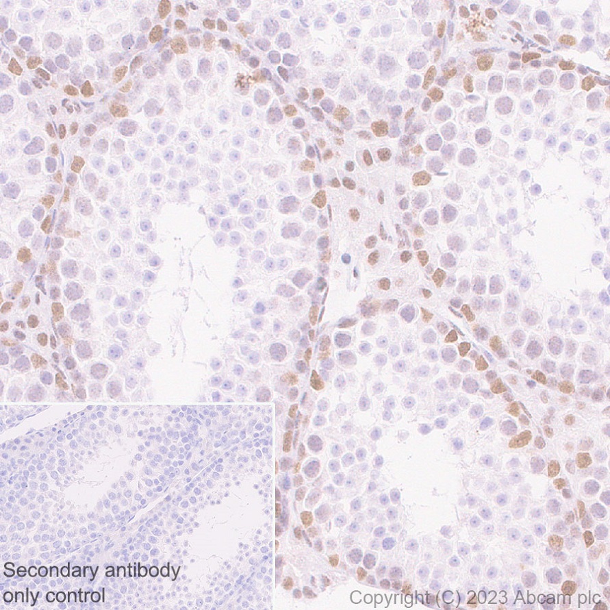 Immunohistochemistry (Formalin/PFA-fixed paraffin-embedded sections) - Anti-MLH1 antibody [EPR26314-1] - BSA and Azide free (ab315012), expandable thumbnail