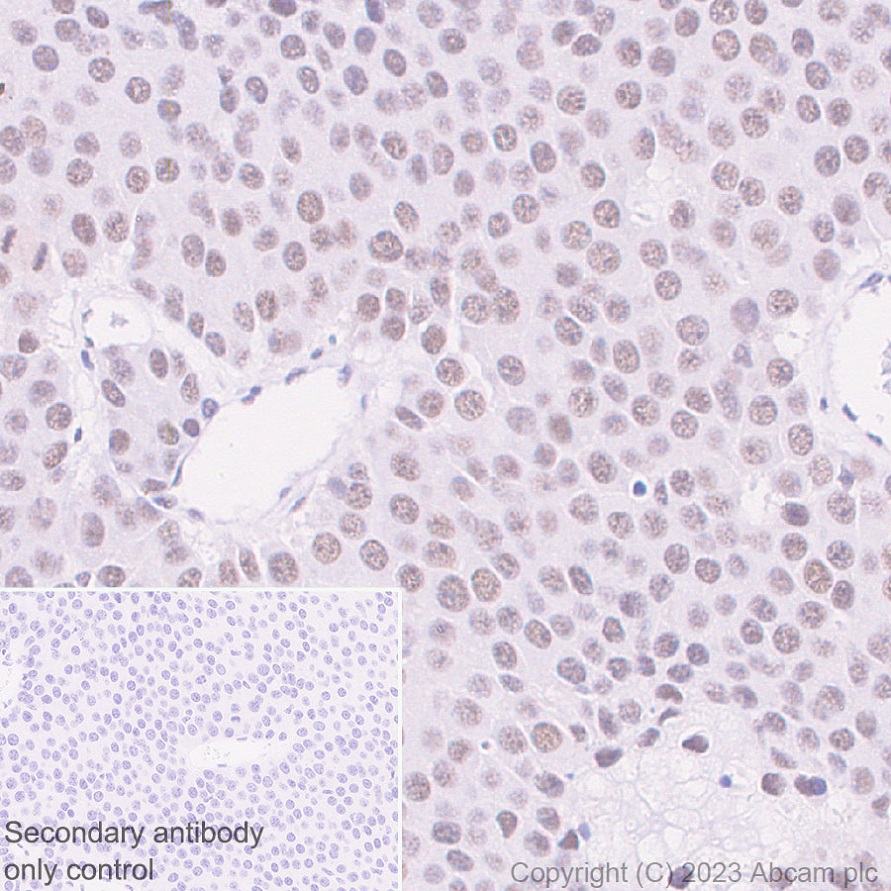 Immunohistochemistry (Formalin/PFA-fixed paraffin-embedded sections) - Anti-MLH1 antibody [EPR26314-1] - BSA and Azide free (ab315012), expandable thumbnail