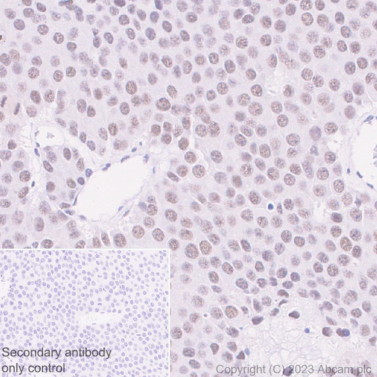 Immunohistochemistry (Formalin/PFA-fixed paraffin-embedded sections) - Anti-MLH1 antibody [EPR26314-1] - BSA and Azide free (AB315012)