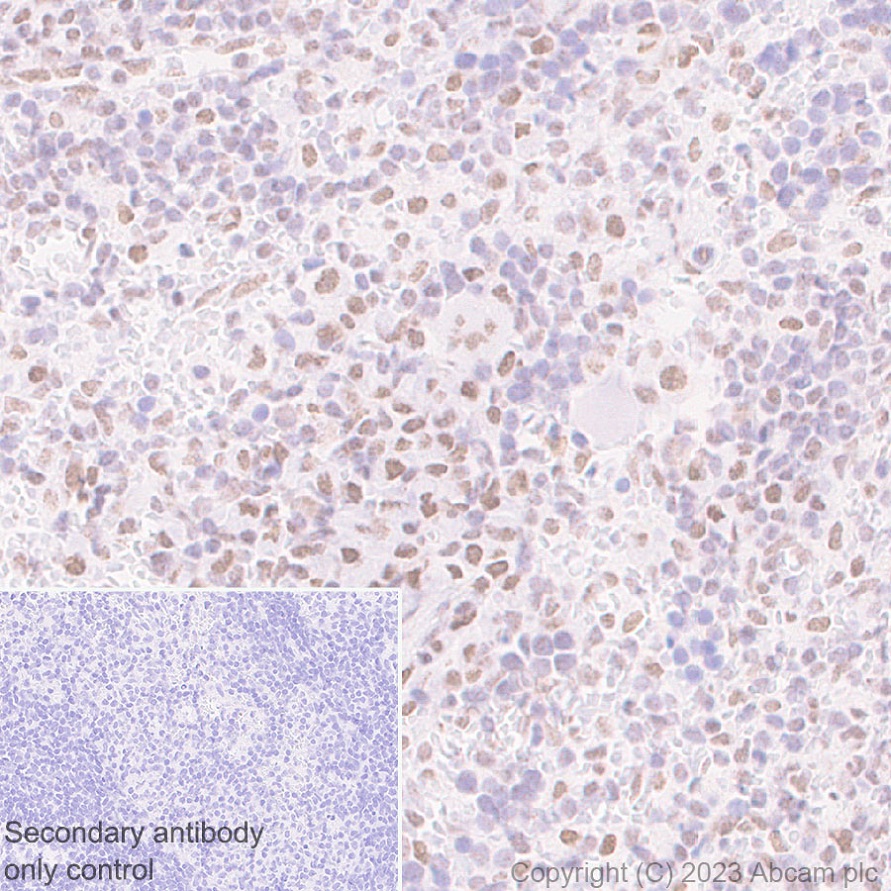 Immunohistochemistry (Formalin/PFA-fixed paraffin-embedded sections) - Anti-MLH1 antibody [EPR26314-1] - BSA and Azide free (ab315012), expandable thumbnail