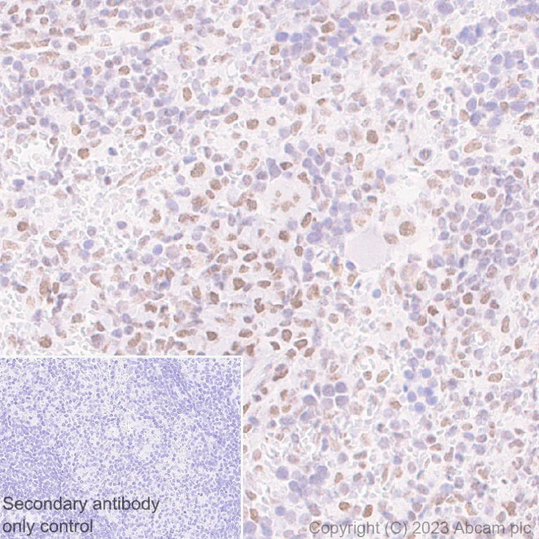 Immunohistochemistry (Formalin/PFA-fixed paraffin-embedded sections) - Anti-MLH1 antibody [EPR26314-1] - BSA and Azide free (AB315012)